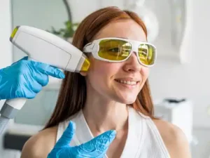 laser to remove dark spots on face