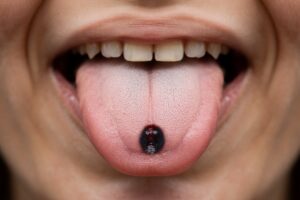 small dark spot on tongue