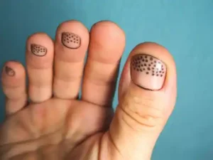 Agelyss Dark Spot Remover 