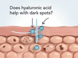 does hyaluronic acid help with dark spots