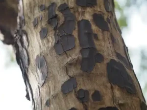 Fraxel laser for dark spots