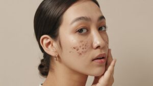 Korean skincare for dark spots and hyperpigmentation
