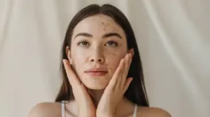 Why Do My Legs Have Dark Spots