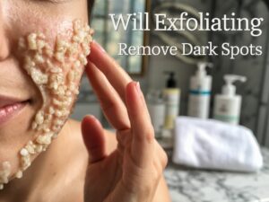 Will exfoliating remove dark spots