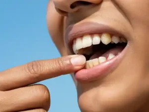 dark spots on potatoes