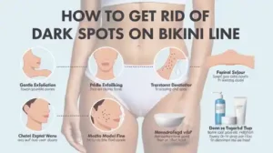 how to get rid of dark spots on bikini line