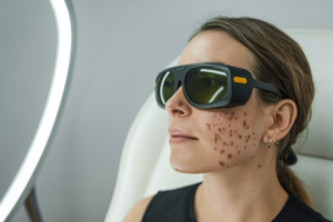 shea butter dark spots