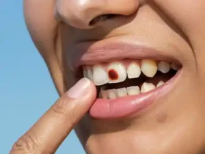 turmeric for dark spots